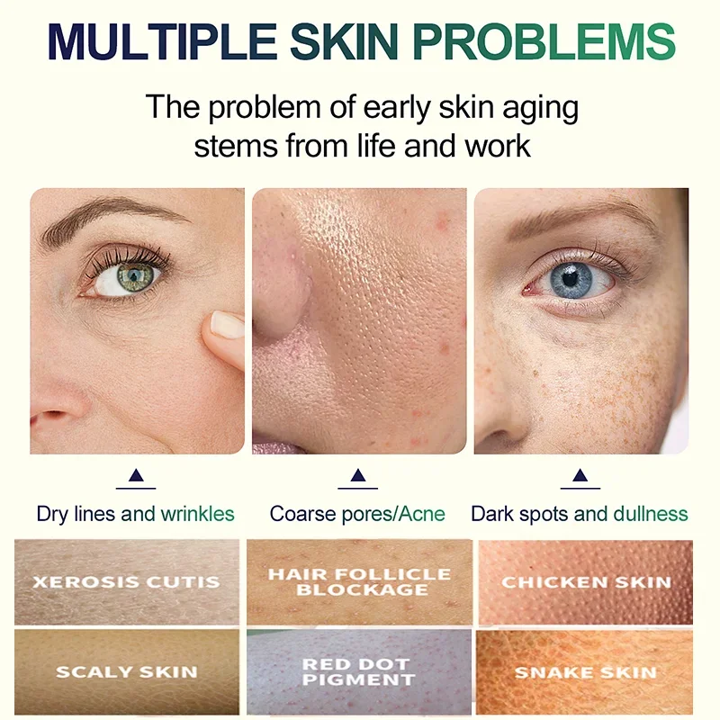 2. Nesil Salisilik Asit Yüz Pe - Glycolic Acid Exfoliant incelemesi ve fiyatı