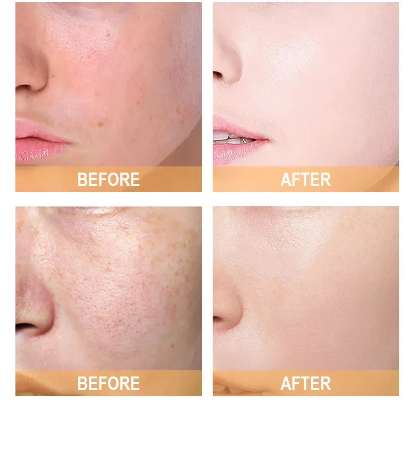 %7 Glikolik Asit Tonik Solüsyo - Glycolic Acid Exfoliant incelemesi ve fiyatı