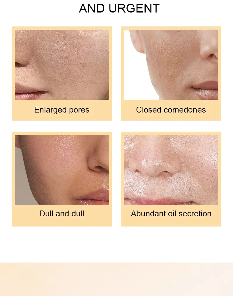 %7 Glikolik Asit Tonik Solüsyo - Glycolic Acid Exfoliant incelemesi ve fiyatı